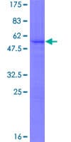 Human SNRNP27 Protein (Recombinant GST)