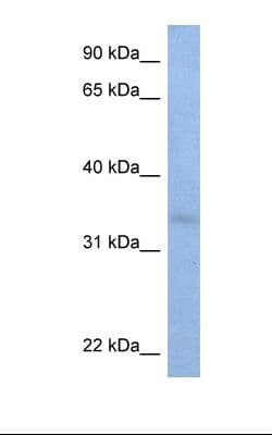 ST6GALNAC3 Antibody (C-Terminus)