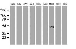Monoclonal Mouse anti-Human VASP Antibody (clone OTI1F3, IHC, WB)