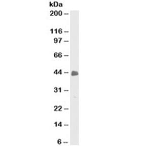 Cytokeratin 8+18 Antibody (clone C-51)