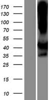 LIMS2 Protein (Over-Expression Lysate Myc-DDK (Flag))