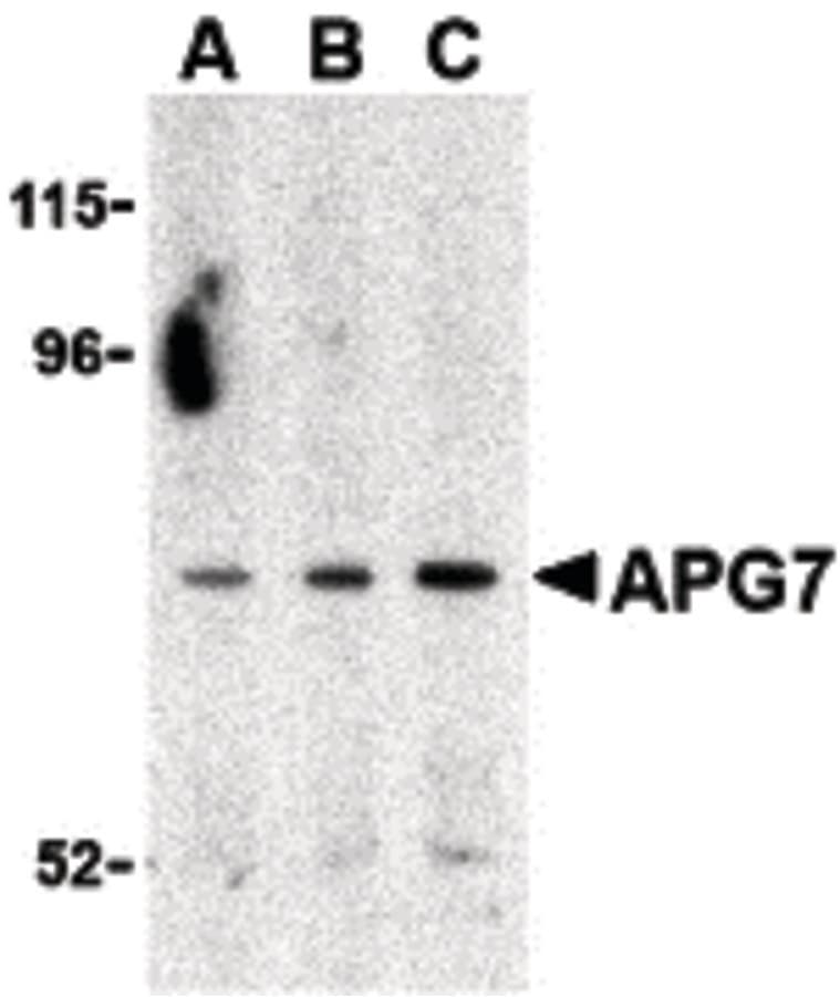 IHC-plus™ Polyclonal Rabbit anti-Human Apg7 / ATG7 Antibody (IHC, IF, WB)