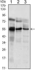 IHC-plus™ Monoclonal Mouse anti-Human ETV5 / ERM Antibody (clone 3H3, aa181-291, IHC, WB)