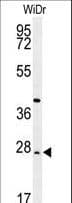 Polyclonal Rabbit anti-Human DIRAS3 / ARHI Antibody (IHC, WB)