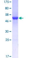 Human GSTA1 Protein (Recombinant GST)
