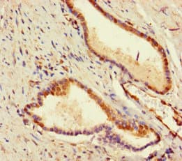ADCK2 Antibody