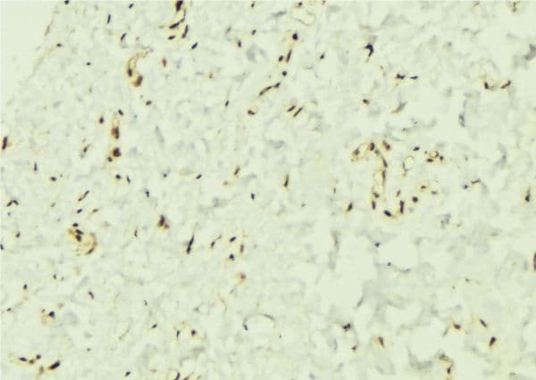 TCF4 Antibody