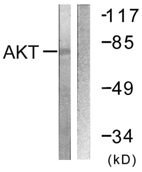 Polyclonal Rabbit anti-Human AKT1 Antibody (p326, IHC, IF, WB)
