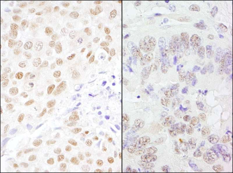 Polyclonal Rabbit anti-Human CSTF3 Antibody (aa667-717, IHC, WB)