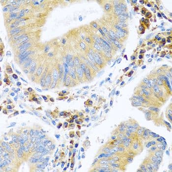 MANF / ARMET Antibody
