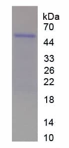 Rat CCN5 Protein (Recombinant His)