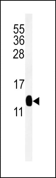 CMC2 / C16orf61 Antibody (aa1-30)