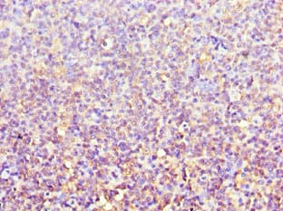 ACTR3B / ARP4 Antibody (aa189-418)