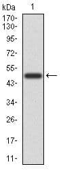 CD6 Antibody (Amino Acid: 472-668, clone 6B9)