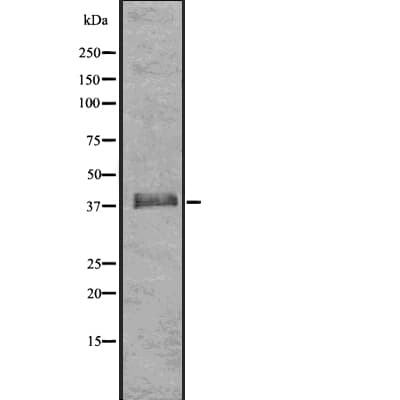 HDAC11 Antibody
