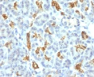 KRT19 / CK19 / Cytokeratin 19 Antibody (clone KRT19/799)