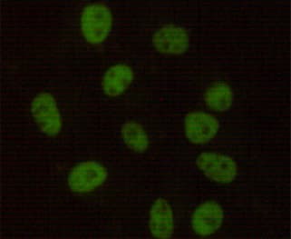 PRKDC / DNA-PKcs Antibody