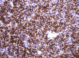 CA12 / Carbonic Anhydrase XII Antibody (clone OTI1A6)