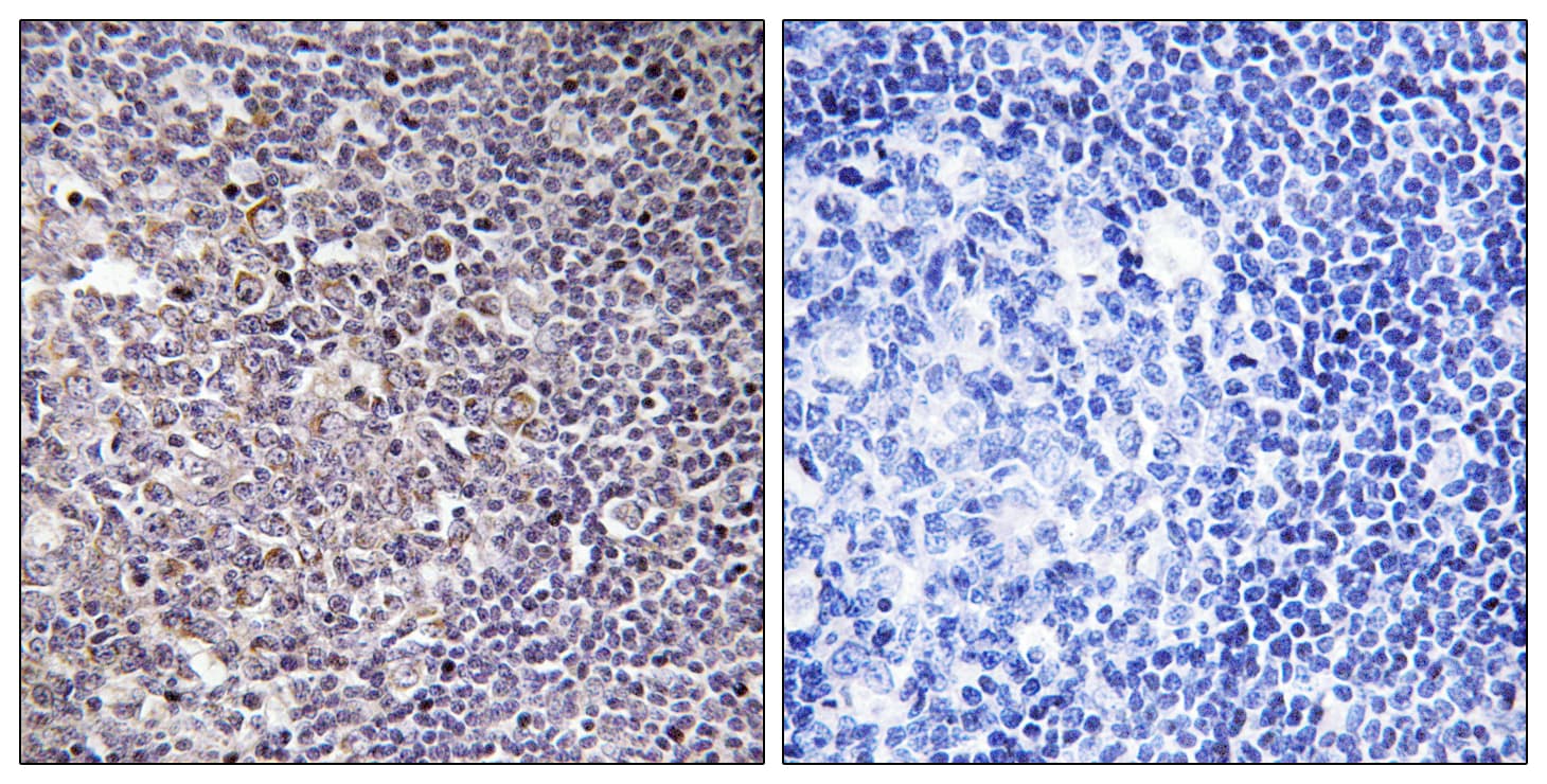 Polyclonal Rabbit anti-Human BCAS4 Antibody (aa31-80, IHC, WB)