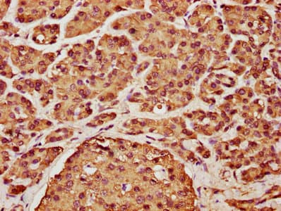 CCND2 / Cyclin D2 Antibody (aa1-289)