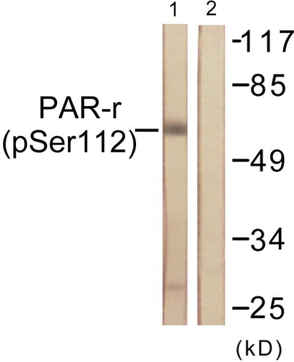 PPARG / PPAR Gamma Antibody (phospho-Ser112)
