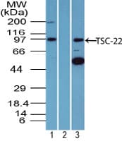 TSC22D1 / TSC22 Antibody (aa100-150)