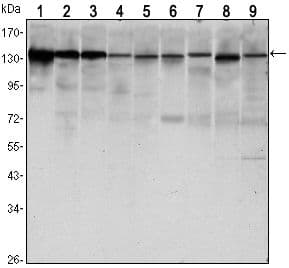 Monoclonal Mouse anti-Human CDH1 / E Cadherin Antibody (clone 7H12, IHC, WB)