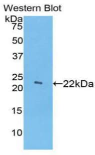 HP / Haptoglobin Antibody (aa71-248, Biotin)