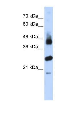 Polyclonal Rabbit anti-Human FBXL2 Antibody (aa71-120, WB)