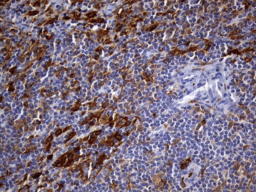 UBE3B Antibody (aa768-1068, clone OTI3F10, Carrier-free)