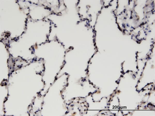 CDK19 / CDK11 Antibody (clone 3D7)