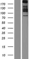 Human COL7A1 / Collagen VII Protein (Over-Expression Lysate Myc-DDK (Flag))