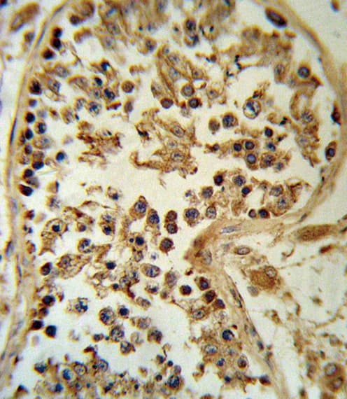 SMYD3 Antibody (aa7-35)