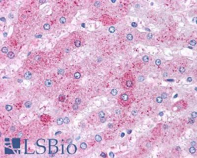 PathPlus™ Polyclonal Rabbit anti-Human VPAC2 / VIPR2 Antibody (C-Terminus, IHC)