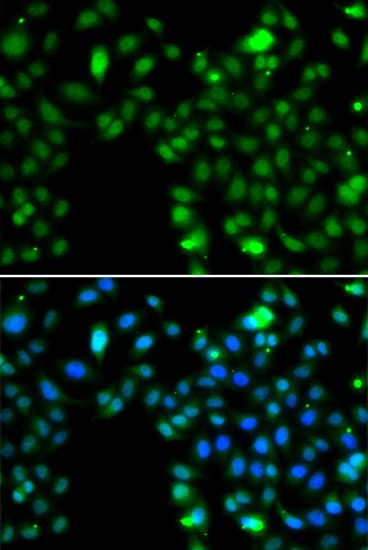 Polyclonal Rabbit anti-Human ING5 Antibody (IHC, IF, WB)