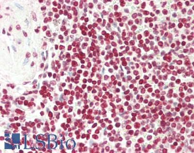 IHC-plus™ FOXP3 Antibody
