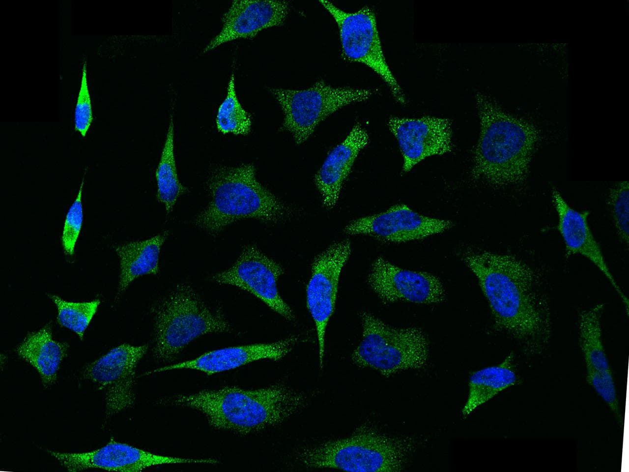 VEGF 165 Antibody (Preservative Free)