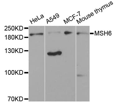 MSH6 Antibody