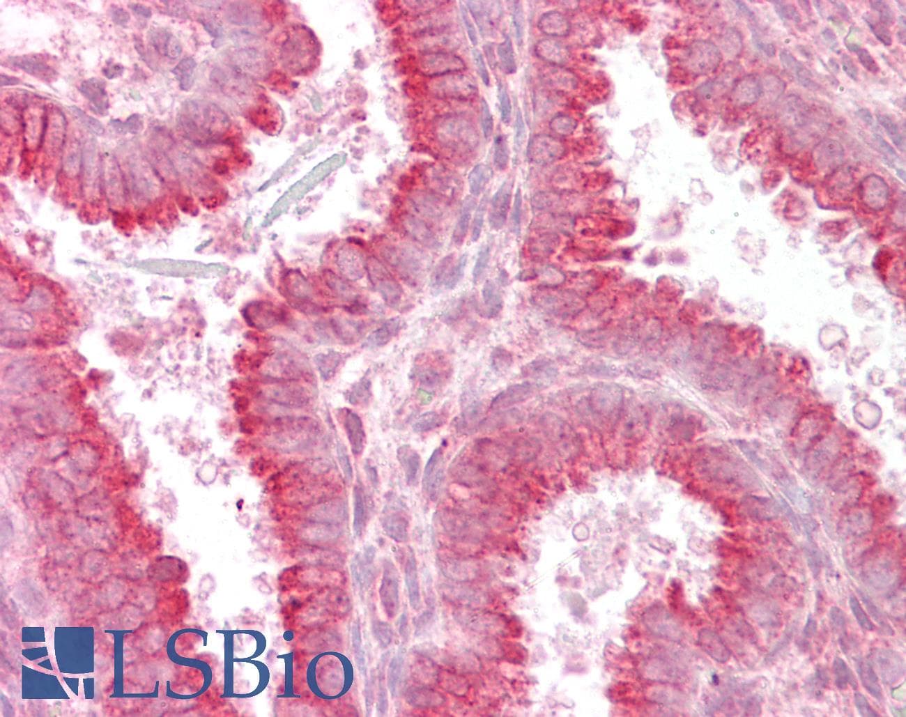 IHC-plus™ Polyclonal Goat anti-Human USP28 Antibody (aa674-685, IHC)