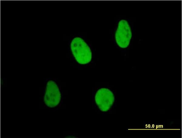 IHC-plus™ XRCC6 / Ku70 Antibody (clone 4C2-1A6)