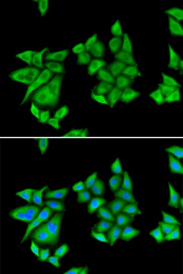 Polyclonal Rabbit anti-Human UROD Antibody (IHC, IF, WB)