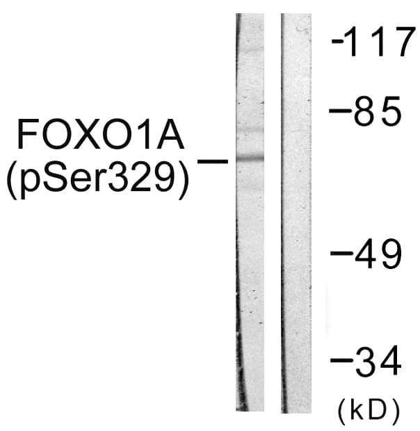 FOXO1 / FKHR Antibody (phospho-Ser329)