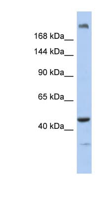 Polyclonal Rabbit anti-Human KIAA0284 Antibody (aa551-600, WB)