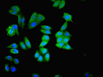 Polyclonal Rabbit anti-Human MAPK3 / ERK1 Antibody (IHC, WB)