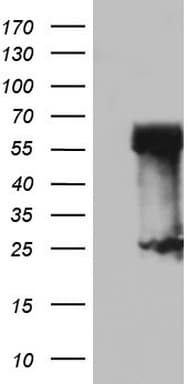 RIPK3 / RIP3 Antibody (aa233-518, clone OTI2H8)