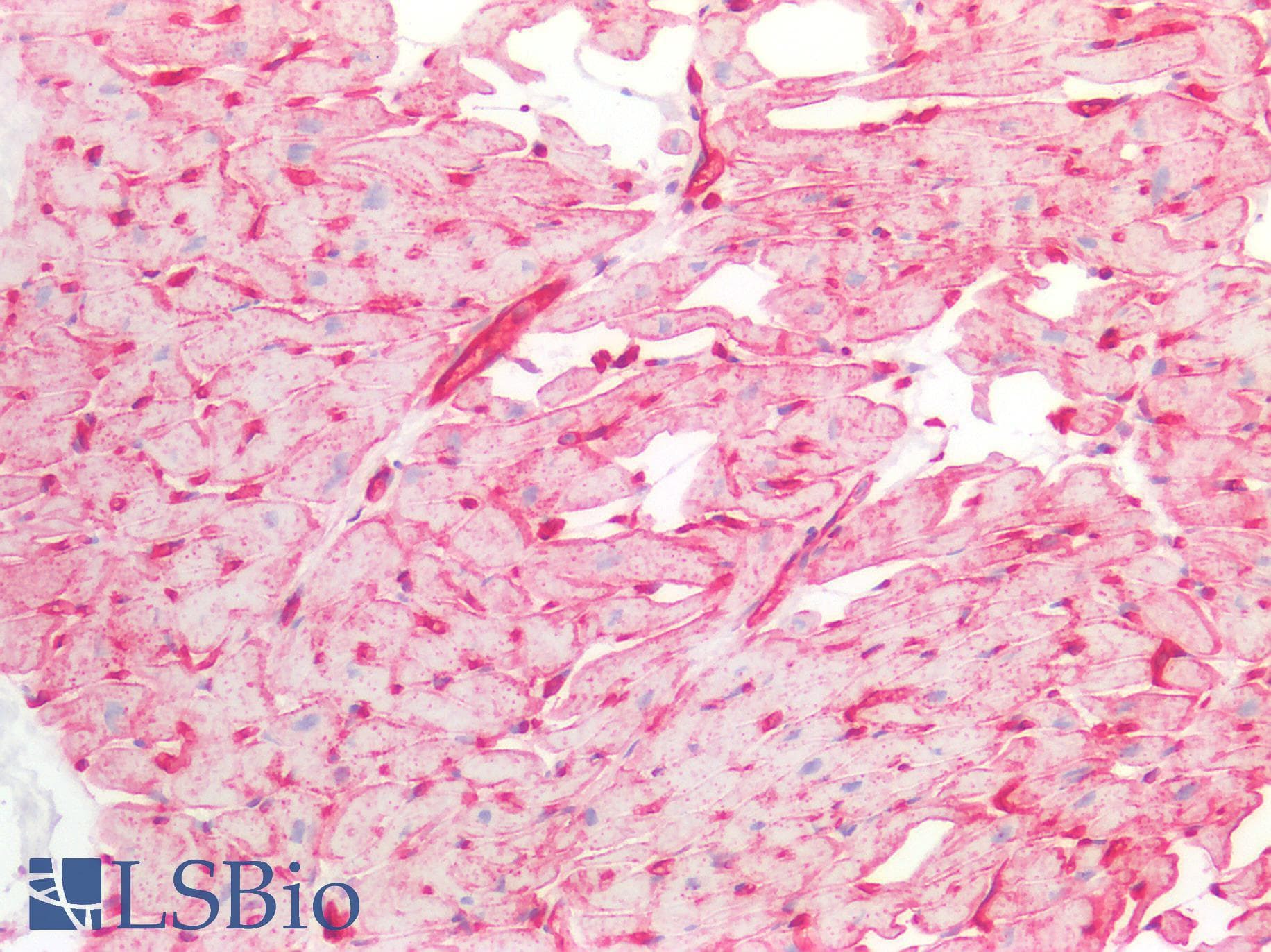 PathPlus™ CAV1 / Caveolin 1 Antibody (C-Terminus)