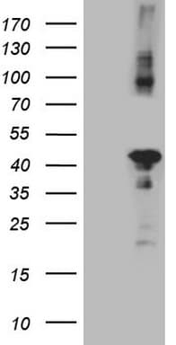 Monoclonal Mouse anti-Human CIAPIN1 / Anamorsin Antibody (clone OTI5A6, aa97-312, IHC, WB)