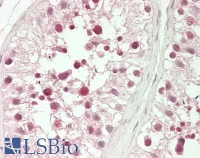 IHC-plus™ KLF5 / BTEB2 Antibody