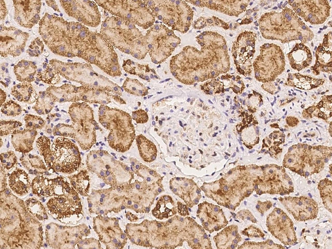 LHFPL2 Antibody