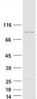 Human PRKRIR Protein (Recombinant Myc-DDK (Flag))